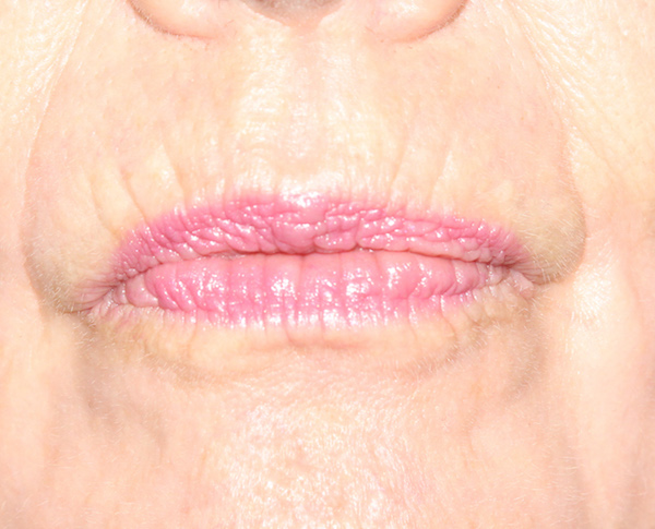 Facial wrinkles Royalty Free Vector Image - VectorStock