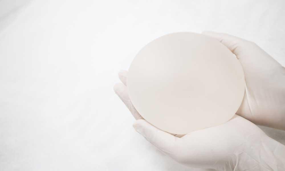 What is a Breast Implant Exchange? 